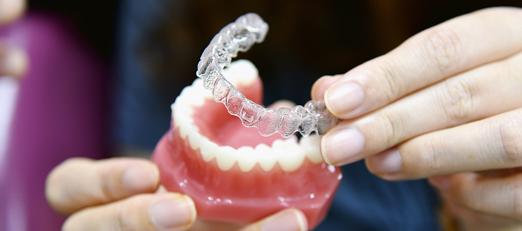 How Long Does Invisalign Treatment Take?