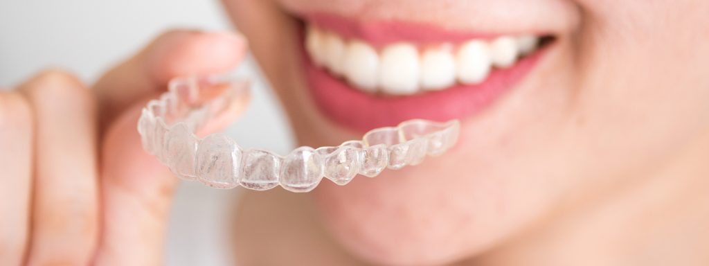 Invisalign Westport